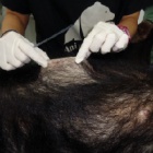 Surgery stops rescued bear’s pain after years of agony and neglect